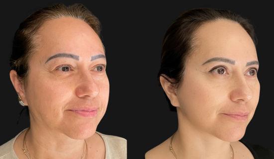 face-06