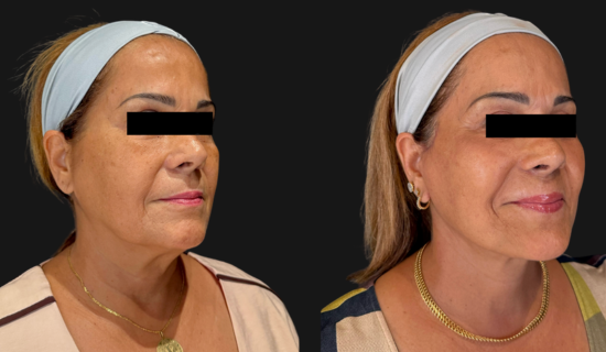 face-5