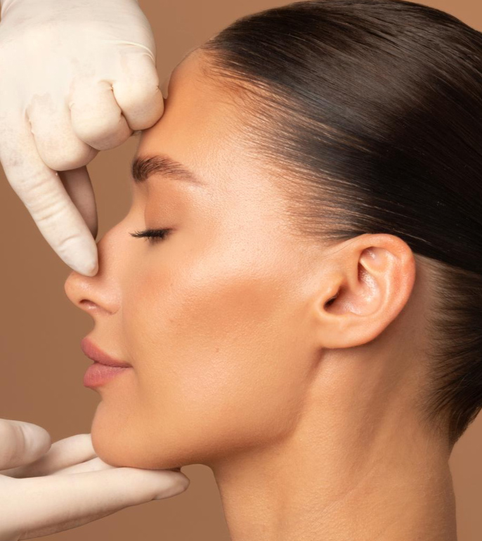 rinoplastia03